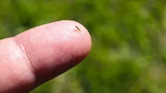  Wie man Splitter ohne Nadeln und Schmerzen loswird